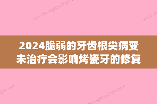 2024脆弱的牙齿根尖病变未治疗会影响烤瓷牙的修复时间吗(烤瓷牙后会坏死)