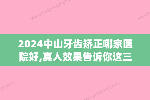 2024中山牙齿矫正哪家医院好,真人效果告诉你这三家正畸真不错(中山大学附属第三医院牙齿矫正多少钱)