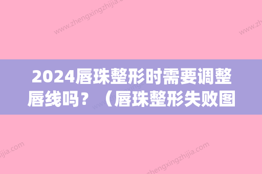 2024唇珠整形时需要调整唇线吗？（唇珠整形失败图片）(纹唇线能改变唇形吗)