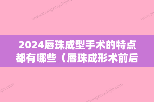 2024唇珠成型手术的特点都有哪些（唇珠成形术前后对比照(图)）(唇珠成形多少钱)