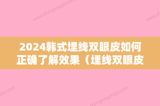 2024韩式埋线双眼皮如何正确了解效果（埋线双眼皮和韩式定点的双眼皮哪种好?）