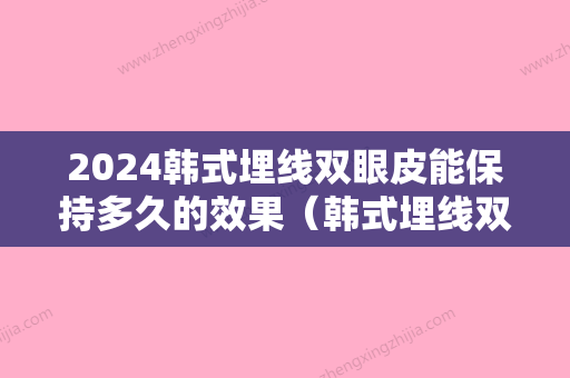 2024韩式埋线双眼皮能保持多久的效果（韩式埋线双眼皮能保持多久的效果图片）