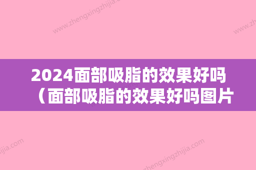 2024面部吸脂的效果好吗（面部吸脂的效果好吗图片）