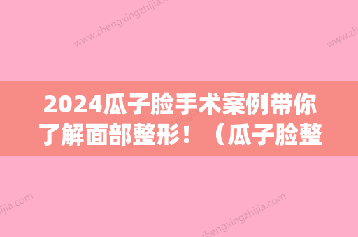 2024瓜子脸手术案例带你了解面部整形！（瓜子脸整容）(圆脸整成瓜子脸的案例)