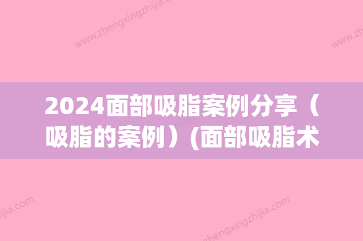 2024面部吸脂案例分享（吸脂的案例）(面部吸脂术)