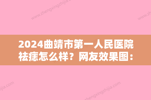 2024曲靖市第一人民医院祛痣怎么样？网友效果图：祛痣30天裸妆也好看！