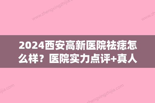 2024西安高新医院祛痣怎么样？医院实力点评+真人案例分享！(西安西京医院祛痣)