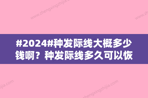 #2024#种发际线大概多少钱啊？种发际线多久可以恢复好？