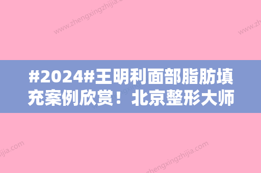 #2024#王明利面部脂肪填充案例欣赏！北京整形大师介绍，价格预览！