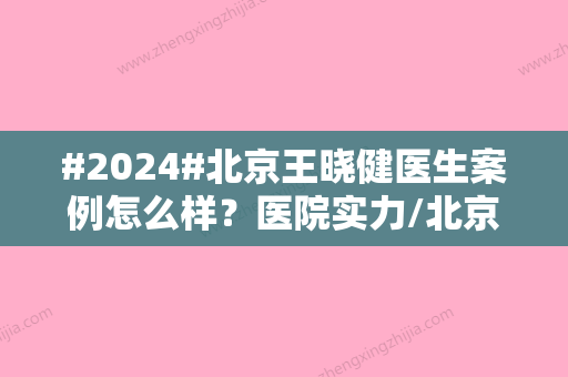 #2024#北京王晓健医生案例怎么样？医院实力/北京/蕾士悦容/附网友反馈