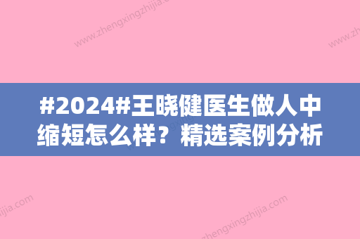 #2024#王晓健医生做人中缩短怎么样？精选案例分析，更新价格表