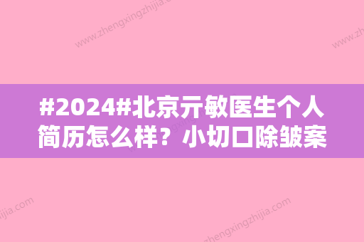 #2024#北京亓敏医生个人简历怎么样？小切口除皱案例分享/医生信息