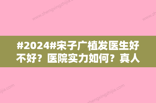 #2024#宋子广植发医生好不好？医院实力如何？真人案例品评