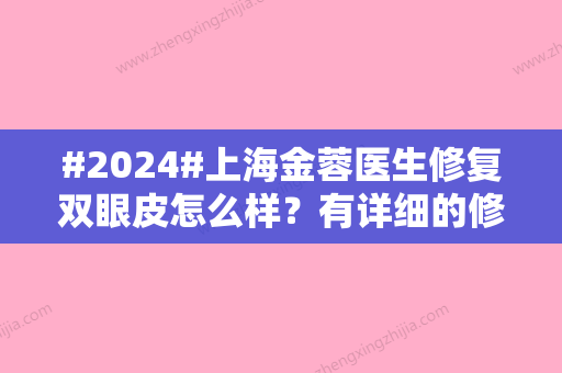 #2024#上海金蓉医生修复双眼皮怎么样？有详细的修复双眼皮案例分享/坐诊医院简介