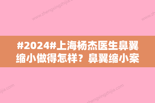 #2024#上海杨杰医生鼻翼缩小做得怎样？鼻翼缩小案例分享和坐诊医院信息推荐