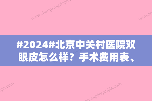 #2024#北京中关村医院双眼皮怎么样？手术费用表	、案例详细介绍