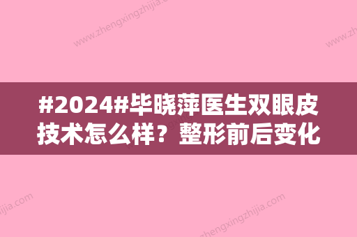 #2024#毕晓萍医生双眼皮技术怎么样？整形前后变化大吗？附上全新价目信息