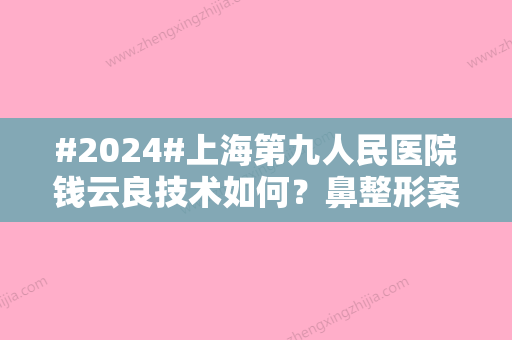 #2024#上海第九人民医院钱云良技术如何？鼻整形案例/医院资料/价格变化情况