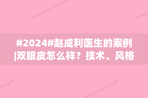 #2024#赵成利医生的案例|双眼皮怎么样？技术、风格以及价格曝光！