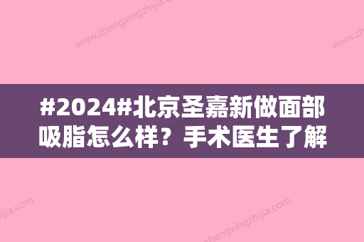 #2024#北京圣嘉新做面部吸脂怎么样？手术医生了解，李朕医生面吸案例公开！