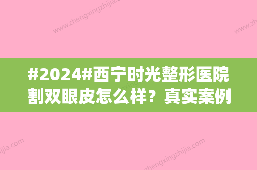 #2024#西宁时光整形医院割双眼皮怎么样？真实案例看实力|本院资料详情