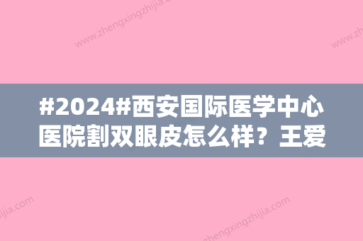 #2024#西安国际医学中心医院割双眼皮怎么样？王爱武医生技术稳妥！