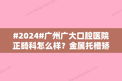 #2024#广州广大口腔医院正畸科怎么样？金属托槽矫正科普！