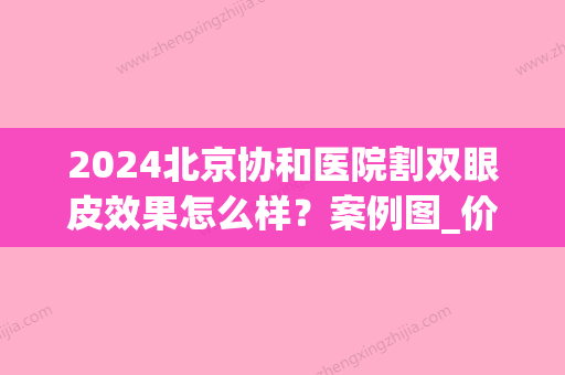 2024北京协和医院割双眼皮效果怎么样？案例图_价格表分享！点进来看看吧！