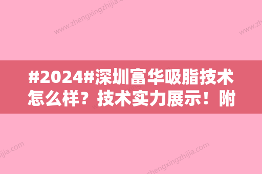 #2024#深圳富华吸脂技术怎么样？技术实力展示！附医生信息