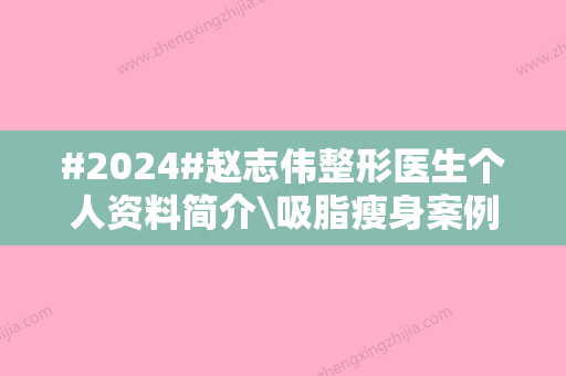 #2024#赵志伟整形医生个人资料简介\吸脂瘦身案例\收费价格表