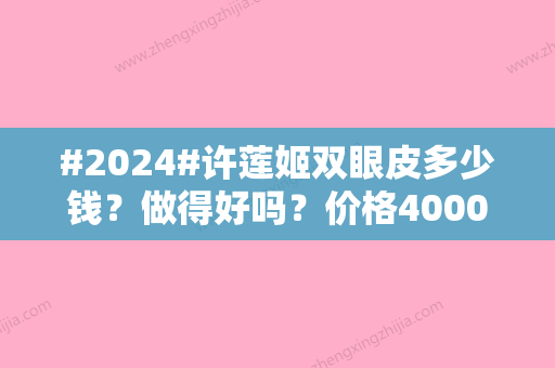 #2024#许莲姬双眼皮多少钱？做得好吗？价格4000元到5000元左右起！