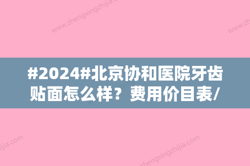 #2024#北京协和医院牙齿贴面怎么样？费用价目表/查看牙齿贴面案例分享