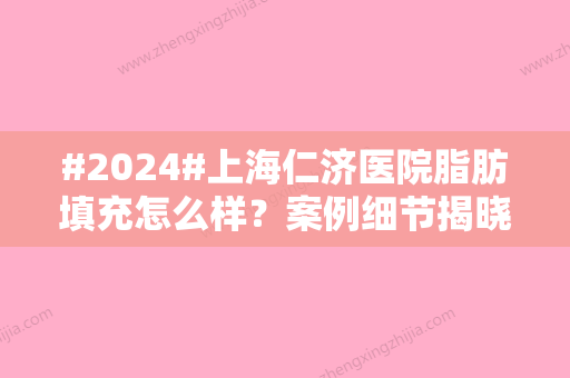 #2024#上海仁济医院脂肪填充怎么样？案例细节揭晓、价格表参考