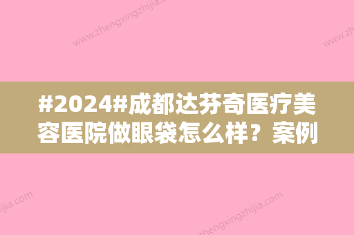 #2024#成都达芬奇医疗美容医院做眼袋怎么样？案例反馈+价格公开，mark！