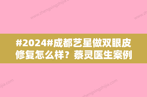 #2024#成都艺星做双眼皮修复怎么样？蔡灵医生案例测评，6D美眼指南！