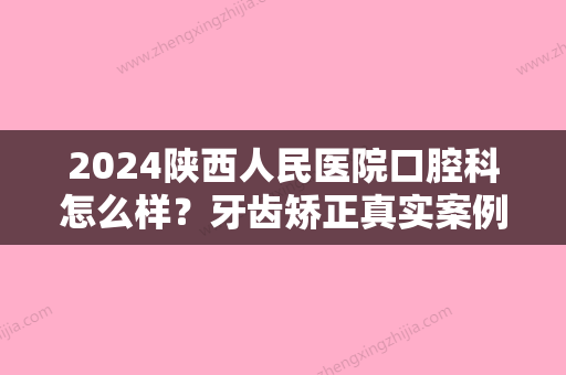 2024陕西人民医院口腔科怎么样？牙齿矫正真实案例+价格表更新一览