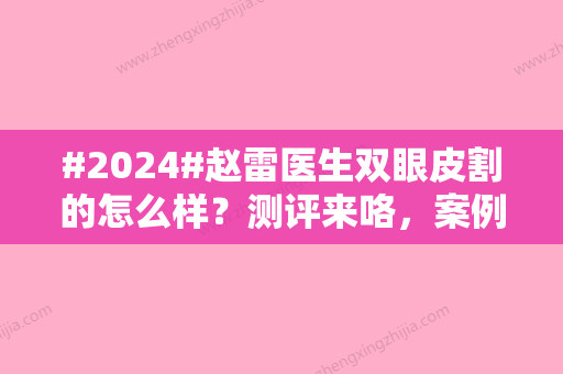 #2024#赵雷医生双眼皮割的怎么样？测评来咯，案例+特点分析！