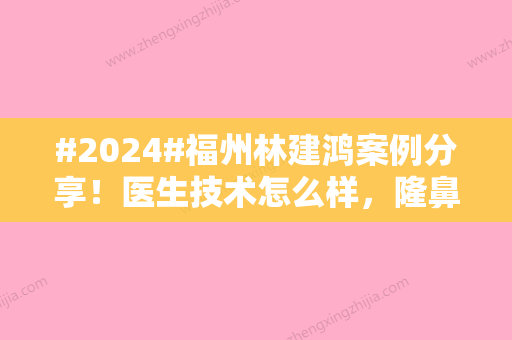 #2024#福州林建鸿案例分享！医生技术怎么样，隆鼻日记帮你测评~