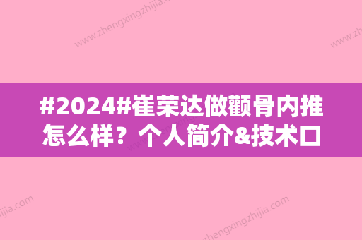 #2024#崔荣达做颧骨内推怎么样？个人简介&技术口碑&整形案例一览