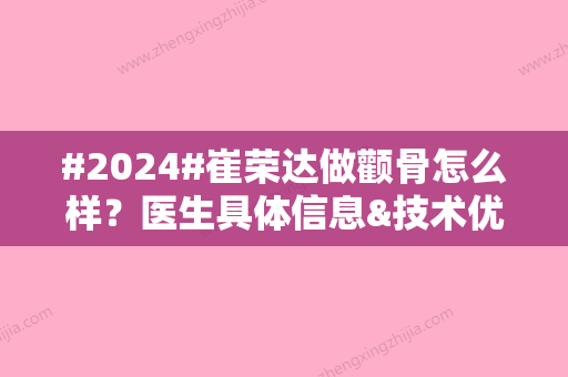 #2024#崔荣达做颧骨怎么样？医生具体信息&技术优势&案例反馈