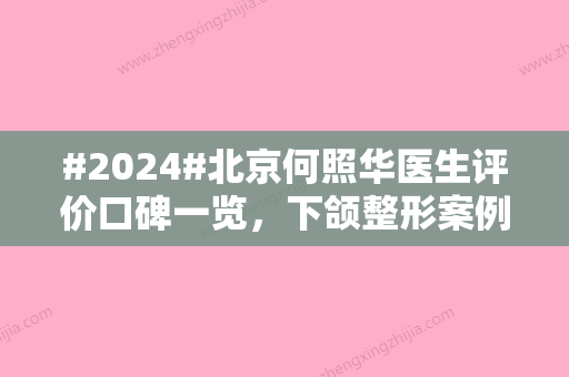 #2024#北京何照华医生评价口碑一览	，下颌整形案例&坐诊医院介绍&价格表