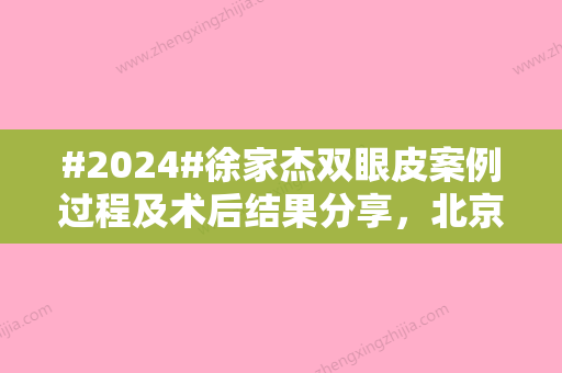 #2024#徐家杰双眼皮案例过程及术后结果分享，北京地区美眼王实力PK