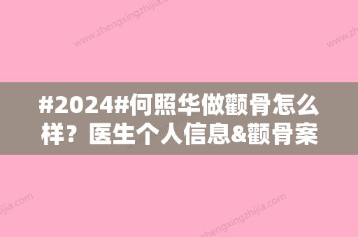 #2024#何照华做颧骨怎么样？医生个人信息&颧骨案例&收费标准表一览