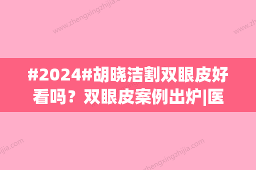 #2024#胡晓洁割双眼皮好看吗？双眼皮案例出炉|医生资料与口碑实力