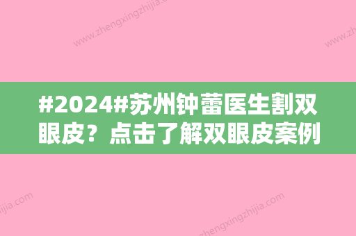 #2024#苏州钟蕾医生割双眼皮？点击了解双眼皮案例过程