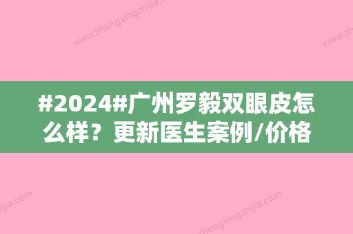 #2024#广州罗毅双眼皮怎么样？更新医生案例/价格参考