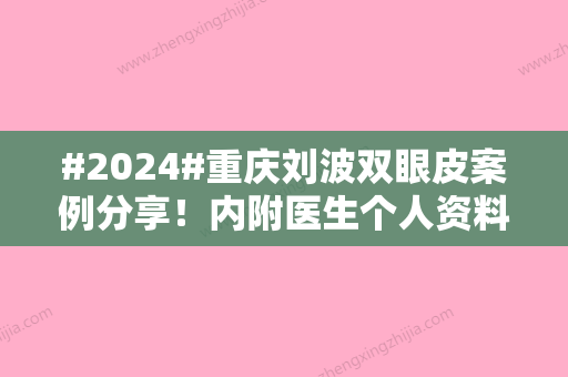 #2024#重庆刘波双眼皮案例分享！内附医生个人资料及坐诊医院介绍