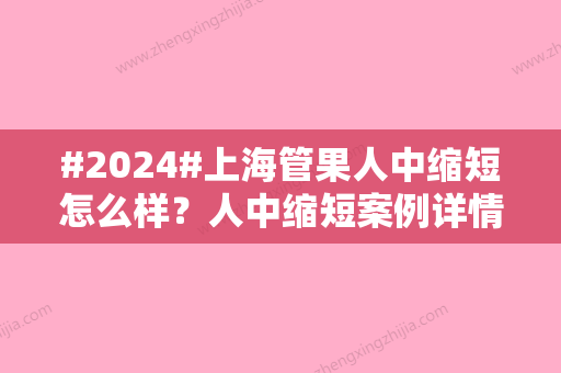 #2024#上海管果人中缩短怎么样？人中缩短案例详情与2024全新价格表