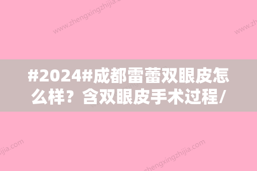 #2024#成都雷蕾双眼皮怎么样？含双眼皮手术过程/坐诊医院信息