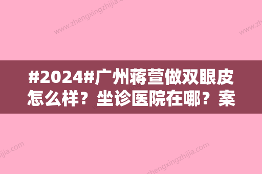 #2024#广州蒋萱做双眼皮怎么样？坐诊医院在哪？案例过程盘点